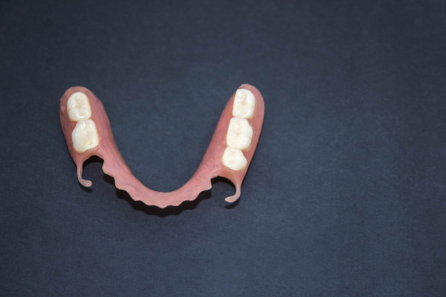 prótesis dental 3
